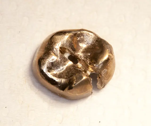 Aufgetrennte Goldkrone